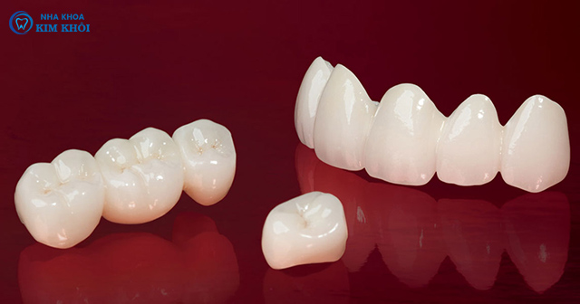 rang-toan-su-zirconia